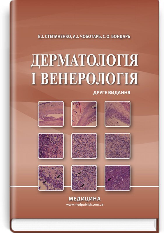 Книга Дерматологія і венерологія. Підручник